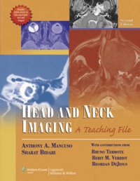copertina di Head and Neck Imaging : A Teaching File