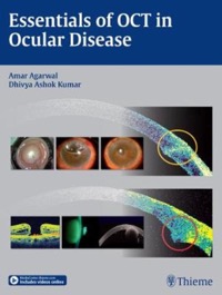 copertina di Essentials of OCT in Ocular Disease ( includes videos online )