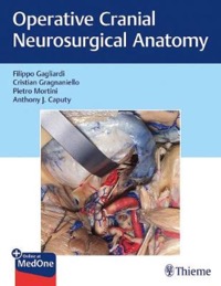 copertina di Operative Cranial Neurosurgical Anatomy