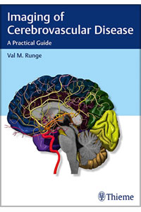 copertina di Imaging of Cerebrovascular Disease - A Practical Guide