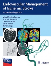 copertina di Endovascular Management of Ischemic Stroke : A Case - based Approach