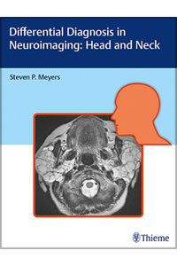 copertina di Differential Diagnosis in Neuroimaging - Head and Neck