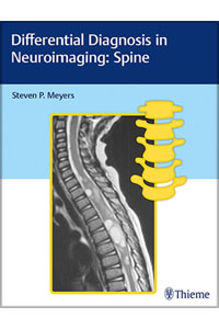 copertina di Differential Diagnosis in Neuroimaging - Spine