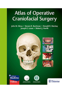 copertina di Atlas of Operative Craniofacial Surgery