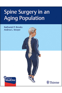 copertina di Spine Surgery in an Aging Population