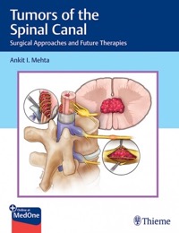 copertina di Tumors of the Spinal Canal : Surgical Approaches and Future Therapies