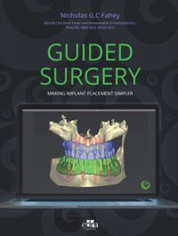 copertina di Guided Surgery . Making implant placement simpler