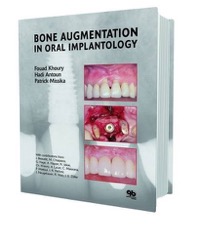 copertina di Bone Augmentation in Oral Implantology
