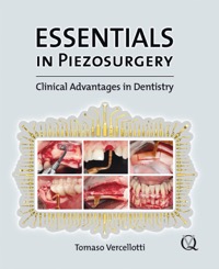 copertina di Essentials in Piezosurgery  - Clinical Advantages in Dentistry 
