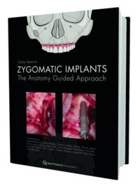 copertina di Zygomatic Implant - The Anatomy - guided approach