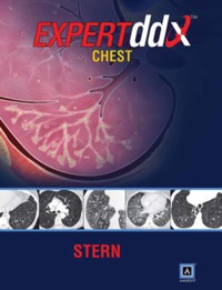 copertina di Expert Differential Diagnoses : Chest