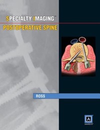 copertina di Specialty Imaging : Postoperative Spine