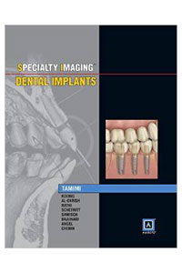 copertina di Specialty Imaging: Dental Implants