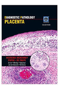 copertina di Diagnostic Pathology : Placenta