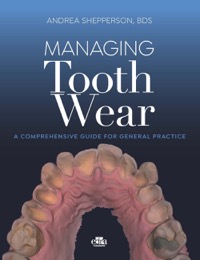 copertina di Managing Tooth Wear - A Comprehensive guide for general Practice