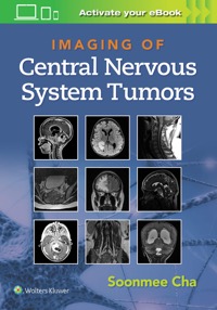 copertina di Imaging of Central Nervous System Tumors