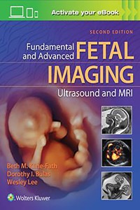 copertina di Fundamental and Advanced Fetal Imaging Ultrasound and MRI ( Magnetic Resonance Imaging ...