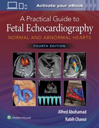 copertina di A Practical Guide to Fetal Echocardiography . Normal and Abnormal Hearts