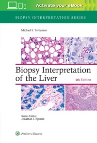 copertina di Biopsy Interpretation of the Liver