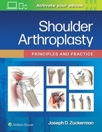 copertina di Shoulder Arthroplasty : Principles and Practice