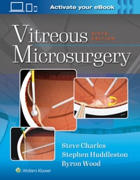 copertina di Vitreous Microsurgery