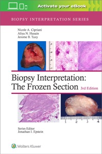 copertina di Biopsy Interpretation : The Frozen Section