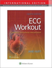 copertina di ECG ( Electrocardiography ) Workout - Exercises in Arrhythmia Interpretation