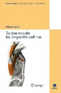 copertina di Tendon transfer for irreparable cuff tear