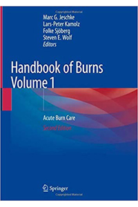 copertina di Handbook of Burns - Acute Burn Care ( Volume 1 )