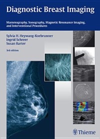 copertina di Diagnostic Breast Imaging - Mammography, Sonography, Magnetic Resonance Imaging ( ...