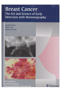 copertina di Breast Cancer - The Art and Science of Early Detection with Mammography - Perception, ...
