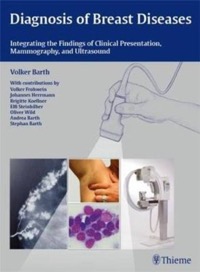 copertina di Diagnosis of Breast Diseases - Clinical Presentation, Mammography, and Ultrasound ...