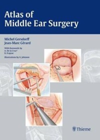 copertina di Atlas of Middle Ear Surgery