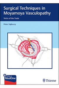copertina di Surgical Techniques in Moyamoya Vasculopathy - Tricks of the Trade