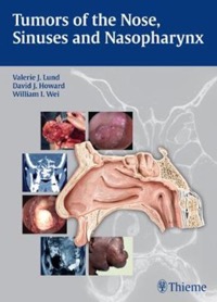 copertina di Tumors of the Nose, Sinuses and Nasopharynx