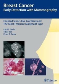 copertina di Breast Cancer - Early Detection with Mammography : Crushed Stone - like Calcifications: ...