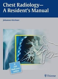 copertina di Chest Radiology : A Resident' s Manual