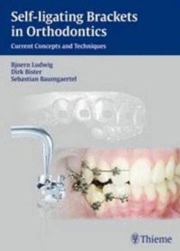 copertina di Self - ligating Brackets in Orthodontics - Current Concepts and Techniques