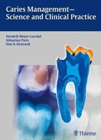 copertina di Caries Management - Science and Clinical Practice