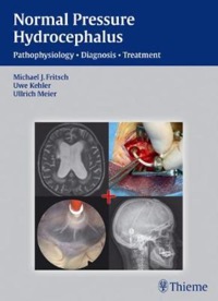 copertina di NPH - Normal Pressure Hydrocephalus - Pathophysiology - Diagnosis - Treatment