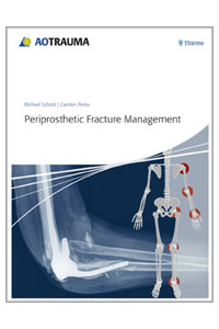 copertina di Periprosthetic Fracture Management