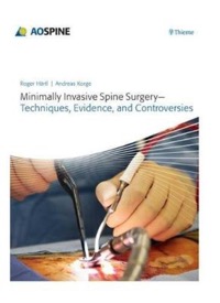 copertina di Minimally Invasive Spine Surgery - Techniques, Evidence, and Controversies