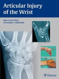 copertina di Articular Injury of the Wrist