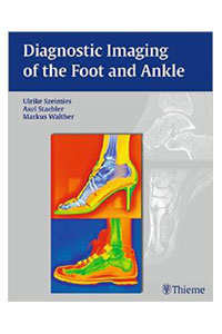 copertina di Diagnostic Imaging of the Foot and Ankle