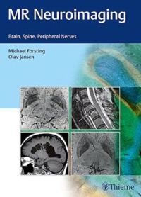 copertina di MR ( Magnetic Resonance ) Neuroimaging - Brain, Spine, and Peripheral Nerves