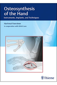 copertina di Osteosynthesis of the Hand - Instruments, Implants, and Techniques