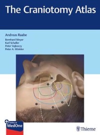 copertina di The Craniotomy Atlas