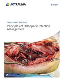 copertina di Principles of Orthopedic Infection Management