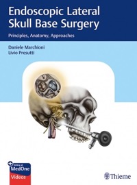 copertina di Endoscopic Lateral Skull Base Surgery - Principles , Anatomy , Approaches