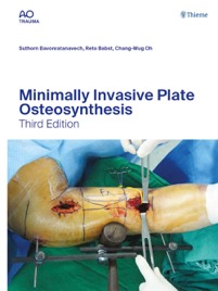 copertina di Minimally Invasive Plate Osteosynthesis